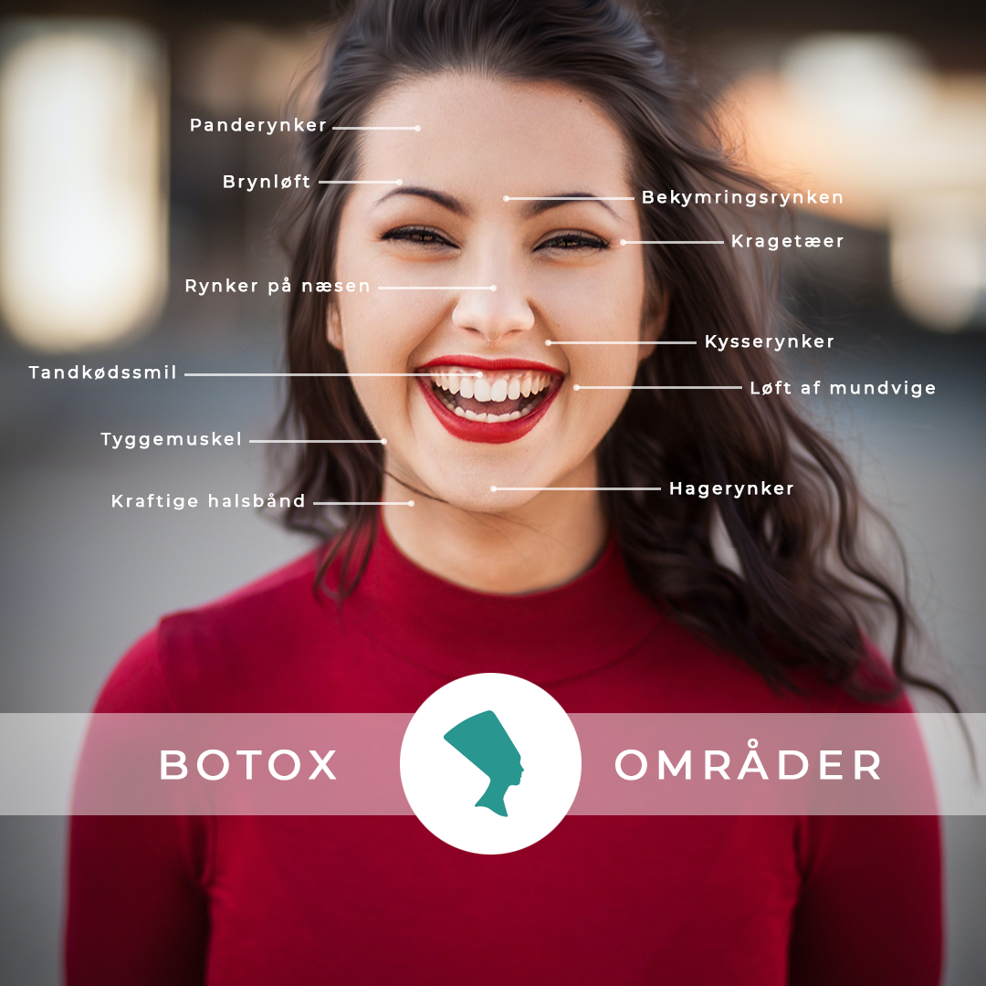 Botox information